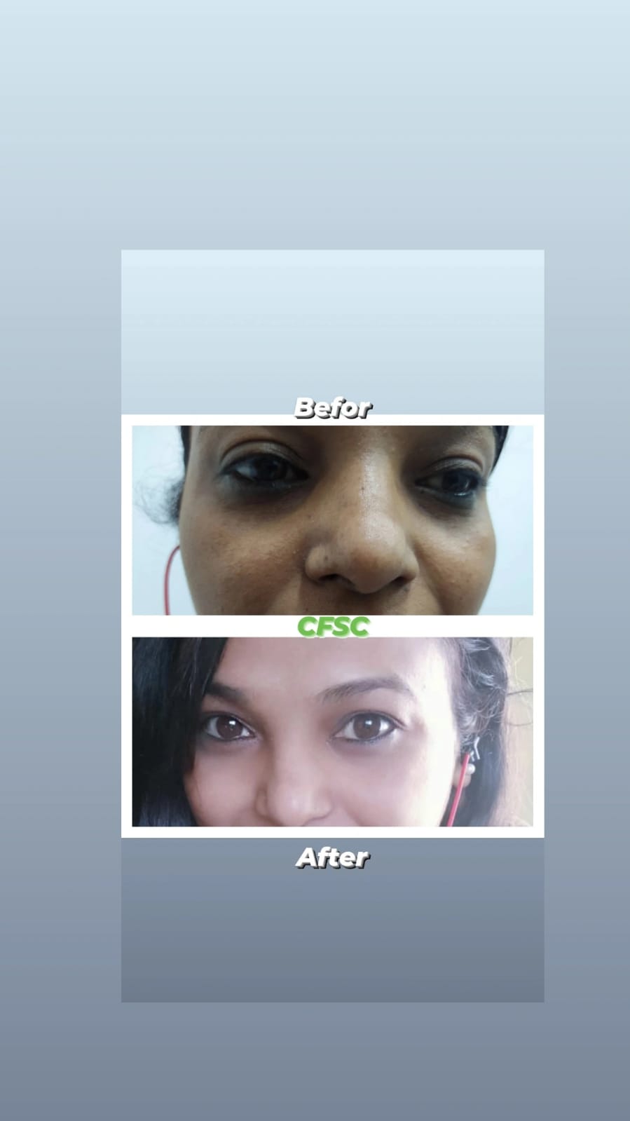 Before After Hair Treatment